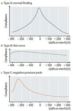tympanometry graph interpretation|Understanding Tympanometry & Tympanogram .
